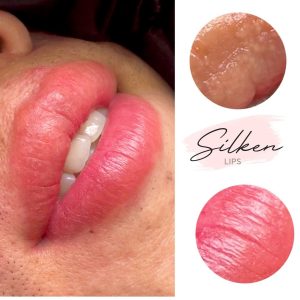 Kỹ thuật Silken Lips