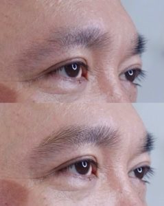 Kỹ Thuật 3RL Rawbrows